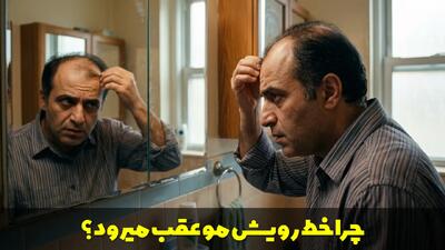  چرا خط رویش مو عقب میرود؟ علت ها و بهترین راهکارهای درمان